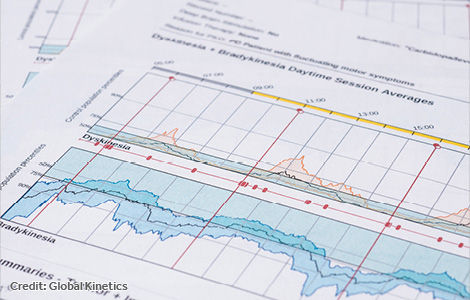 Global kinetics incopy